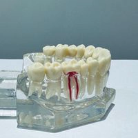Leczenie Endodontyczne